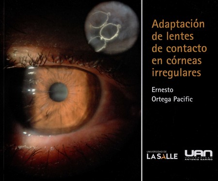 Adaptación de lentes de contac...