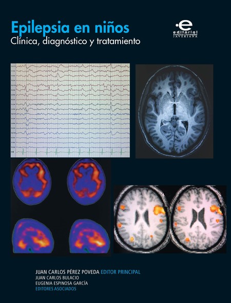 Epilepsia en niños. Clínica, d...