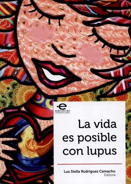 La vida es posible con lupus