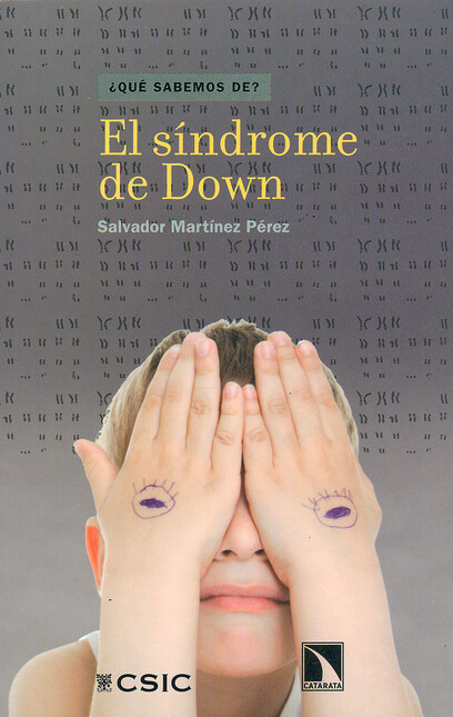 El síndrome de Down