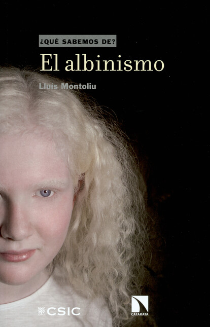 El albinismo