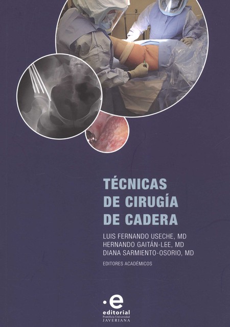 Técnicas de cirugía de cadera