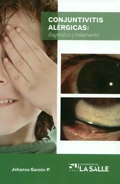 Conjuntivitis alérgicas: diagn...