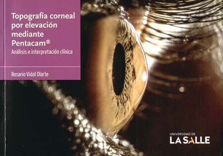 Topografía corneal por elevaci...