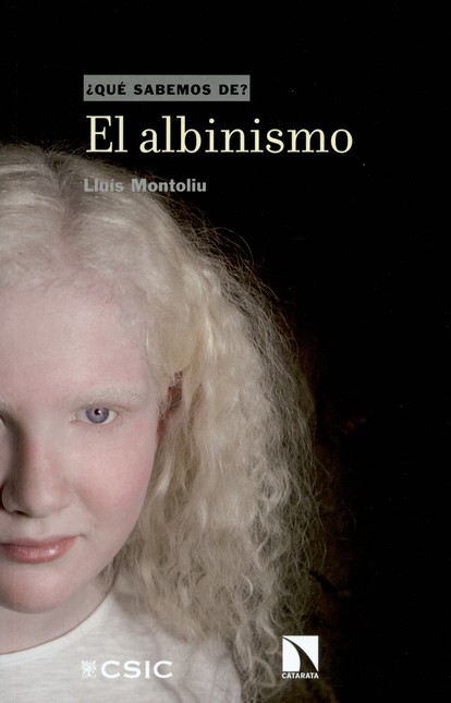 El albinismo